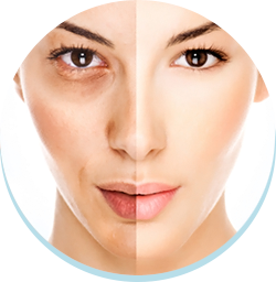 L-Glutathione, Anti-oxidation